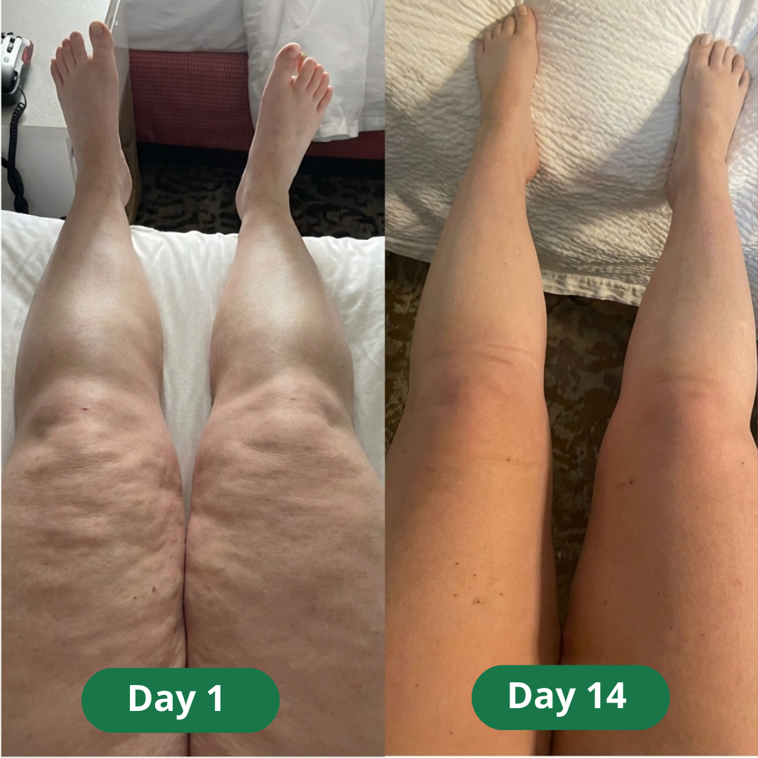 Lymphatic Drainage Wellness Drops